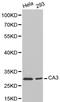 Carbonic Anhydrase 3 antibody, LS-C192474, Lifespan Biosciences, Western Blot image 