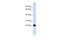 Recoverin antibody, 25-185, ProSci, Western Blot image 