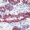 O-6-Methylguanine-DNA Methyltransferase antibody, MA5-13506, Invitrogen Antibodies, Immunohistochemistry paraffin image 