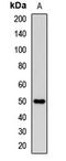 Selectin P Ligand antibody, orb412020, Biorbyt, Western Blot image 