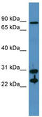 Carbonic Anhydrase 2 antibody, TA342840, Origene, Western Blot image 