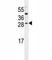 Insulin Like Growth Factor 2 antibody, F41299-0.4ML, NSJ Bioreagents, Flow Cytometry image 