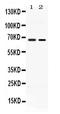 Acid Sensing Ion Channel Subunit 2 antibody, PB10046, Boster Biological Technology, Western Blot image 