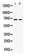 Amiloride-sensitive cation channel 1, neuronal antibody, PB10046, Boster Biological Technology, Western Blot image 