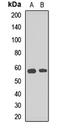 ADP Ribosylation Factor GTPase Activating Protein 3 antibody, LS-C668744, Lifespan Biosciences, Western Blot image 