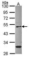 EPC1 antibody, GTX114097, GeneTex, Western Blot image 