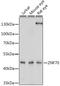 Zinc Finger Protein 70 antibody, A17048, Boster Biological Technology, Western Blot image 