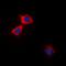 Calcium/Calmodulin Dependent Protein Kinase II Alpha antibody, orb224183, Biorbyt, Immunocytochemistry image 