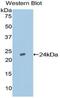 TIMP Metallopeptidase Inhibitor 2 antibody, MBS2001943, MyBioSource, Western Blot image 