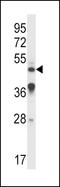 Interleukin 9 Receptor antibody, LS-C165215, Lifespan Biosciences, Western Blot image 