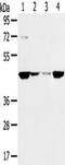SMYD Family Member 5 antibody, TA351731, Origene, Western Blot image 
