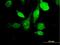 Hyaluronidase-3 antibody, H00008372-B01P, Novus Biologicals, Immunocytochemistry image 
