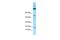 Odorant Binding Protein 2A antibody, A12650, Boster Biological Technology, Western Blot image 