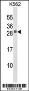 Heparin Binding EGF Like Growth Factor antibody, 58-020, ProSci, Western Blot image 