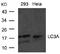 LC3A antibody, AP08079PU-S, Origene, Western Blot image 
