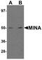 Ribosomal Oxygenase 2 antibody, A32122, Boster Biological Technology, Western Blot image 