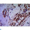 Protein Arginine Methyltransferase 6 antibody, LS-C813101, Lifespan Biosciences, Immunohistochemistry paraffin image 