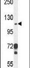 Integrin Subunit Alpha E antibody, PA5-23996, Invitrogen Antibodies, Western Blot image 