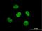Kelch Like Family Member 29 antibody, H00114818-B01P, Novus Biologicals, Immunofluorescence image 