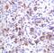 Interferon Regulatory Factor 4 antibody, MA5-16382, Invitrogen Antibodies, Immunohistochemistry paraffin image 