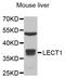 Chondromodulin antibody, A32278, Boster Biological Technology, Western Blot image 