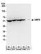 Uridine Monophosphate Synthetase antibody, A304-258A, Bethyl Labs, Western Blot image 