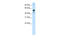 Nuclear Factor, Erythroid 2 Like 2 antibody, 28-932, ProSci, Western Blot image 