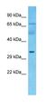 G Protein-Coupled Receptor 107 antibody, orb325490, Biorbyt, Western Blot image 