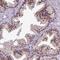 Origin Recognition Complex Subunit 5 antibody, HPA019730, Atlas Antibodies, Immunohistochemistry frozen image 