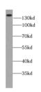 ATPase Plasma Membrane Ca2+ Transporting 2 antibody, FNab06568, FineTest, Western Blot image 