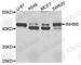 Inhibin Subunit Beta B antibody, A8553, ABclonal Technology, Western Blot image 