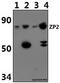 Zona Pellucida Glycoprotein 2 antibody, A05859, Boster Biological Technology, Western Blot image 