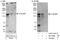 ELM2 And Myb/SANT Domain Containing 1 antibody, A303-157A, Bethyl Labs, Immunoprecipitation image 