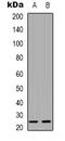 CKLF Like MARVEL Transmembrane Domain Containing 4 antibody, LS-C368889, Lifespan Biosciences, Western Blot image 