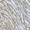 Hexosaminidase Subunit Alpha antibody, 14-425, ProSci, Immunohistochemistry frozen image 