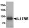 Interleukin 17 Receptor E antibody, LS-B10072, Lifespan Biosciences, Western Blot image 