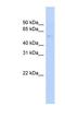 Growth Arrest Specific 8 antibody, NBP1-55497, Novus Biologicals, Western Blot image 