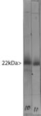 Visinin Like 1 antibody, LS-B10380, Lifespan Biosciences, Western Blot image 