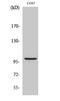 AP2 Associated Kinase 1 antibody, A05368-2, Boster Biological Technology, Western Blot image 