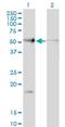 RAD23 Homolog B, Nucleotide Excision Repair Protein antibody, H00005887-M10, Novus Biologicals, Western Blot image 