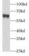 Protein Inhibitor Of Activated STAT 4 antibody, FNab06431, FineTest, Western Blot image 