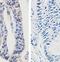 Mucin 16, Cell Surface Associated antibody, orb77318, Biorbyt, Immunohistochemistry paraffin image 