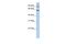 Chaperonin Containing TCP1 Subunit 5 antibody, NBP1-56769, Novus Biologicals, Western Blot image 