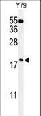 Thioredoxin Domain Containing 12 antibody, LS-C160346, Lifespan Biosciences, Western Blot image 