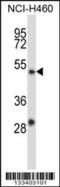 YY2 Transcription Factor antibody, 57-188, ProSci, Western Blot image 