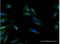 Calcitonin Related Polypeptide Beta antibody, H00000797-B02P-50ug, Novus Biologicals, Immunocytochemistry image 