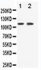 EPH Receptor B3 antibody, LS-C312726, Lifespan Biosciences, Western Blot image 