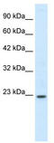 Homeobox protein Hox-B6 antibody, TA329257, Origene, Western Blot image 