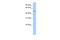 Chaperonin Containing TCP1 Subunit 8 Like 2 antibody, A16124, Boster Biological Technology, Western Blot image 