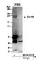 Cyclin Dependent Kinase 12 antibody, NB100-87011, Novus Biologicals, Western Blot image 